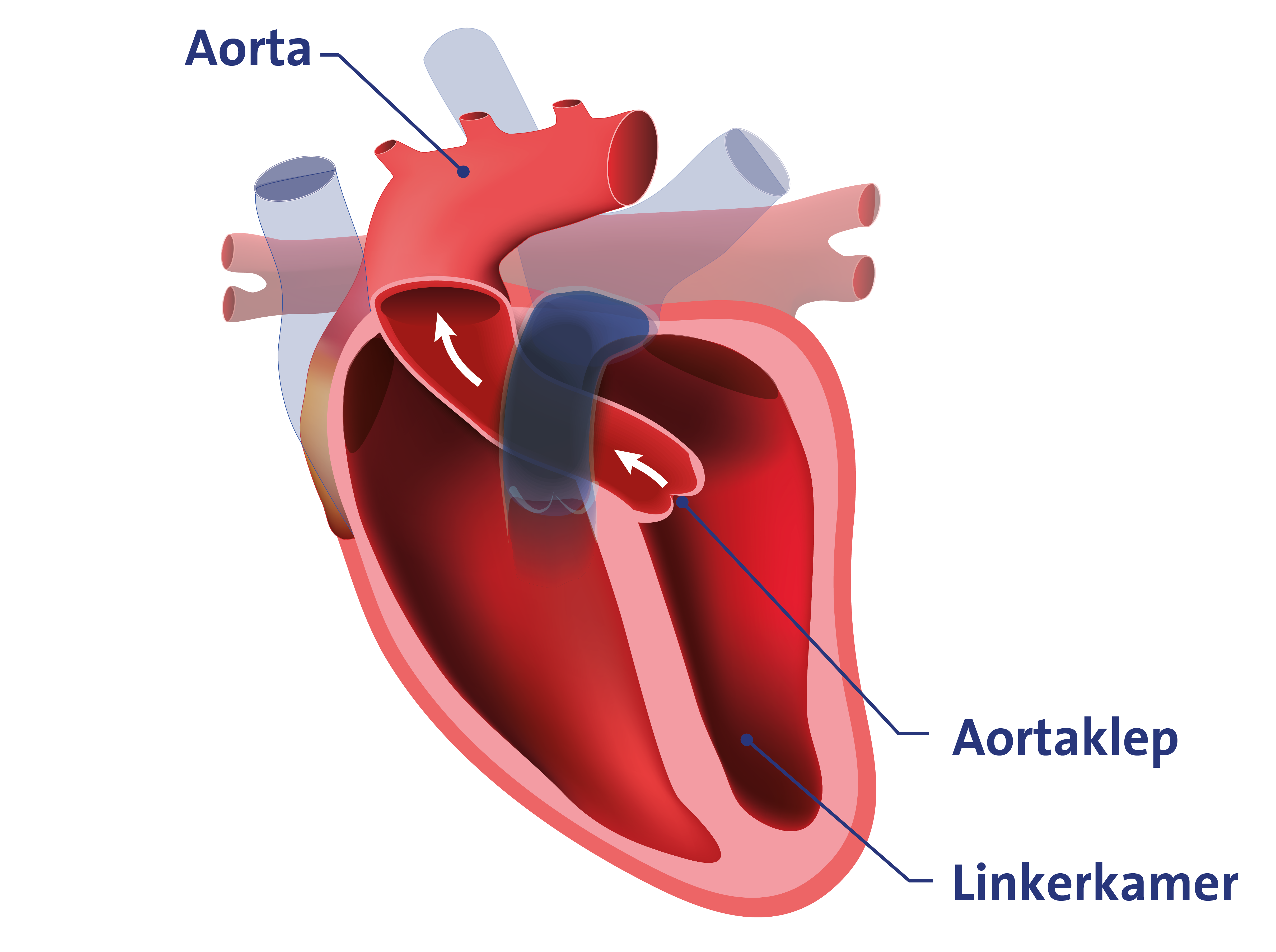 Afbeelding hart, met aorta, aortaklep en linkerkamer aangegeven