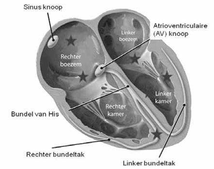 hartoorsprong van extra slagen