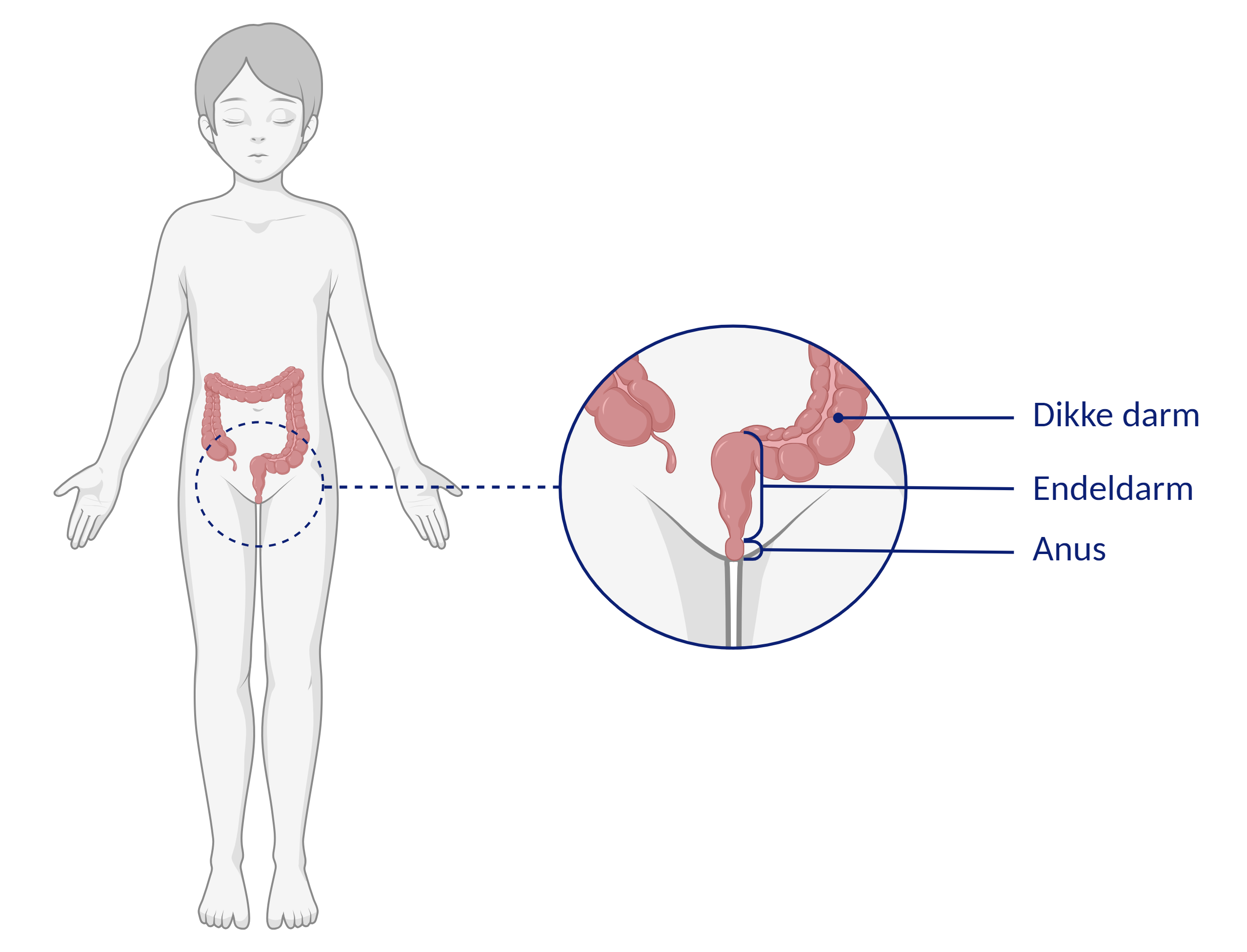 Anorectale manometrie - Patiëntenfolder - Erasmus MC