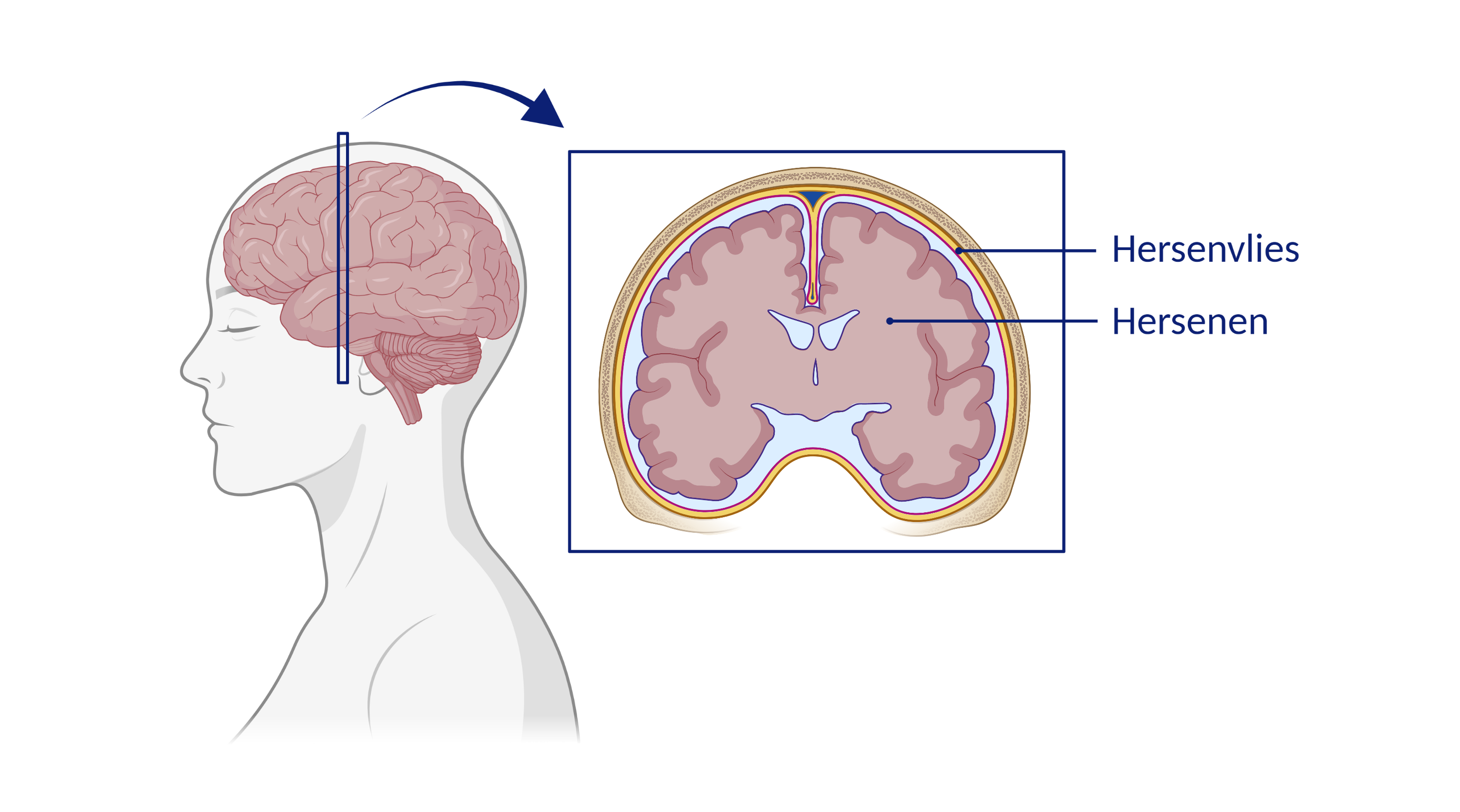 Afbeelding van de hersenen en de hersenvliezen