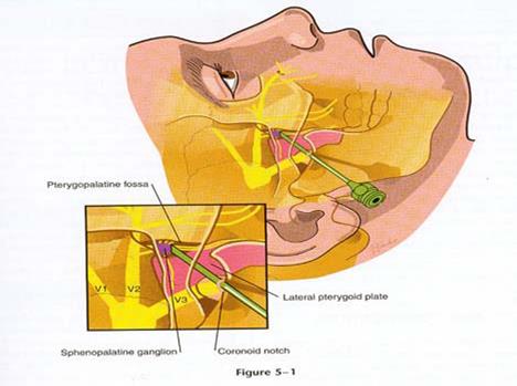 Ganglion pterygopalatinum