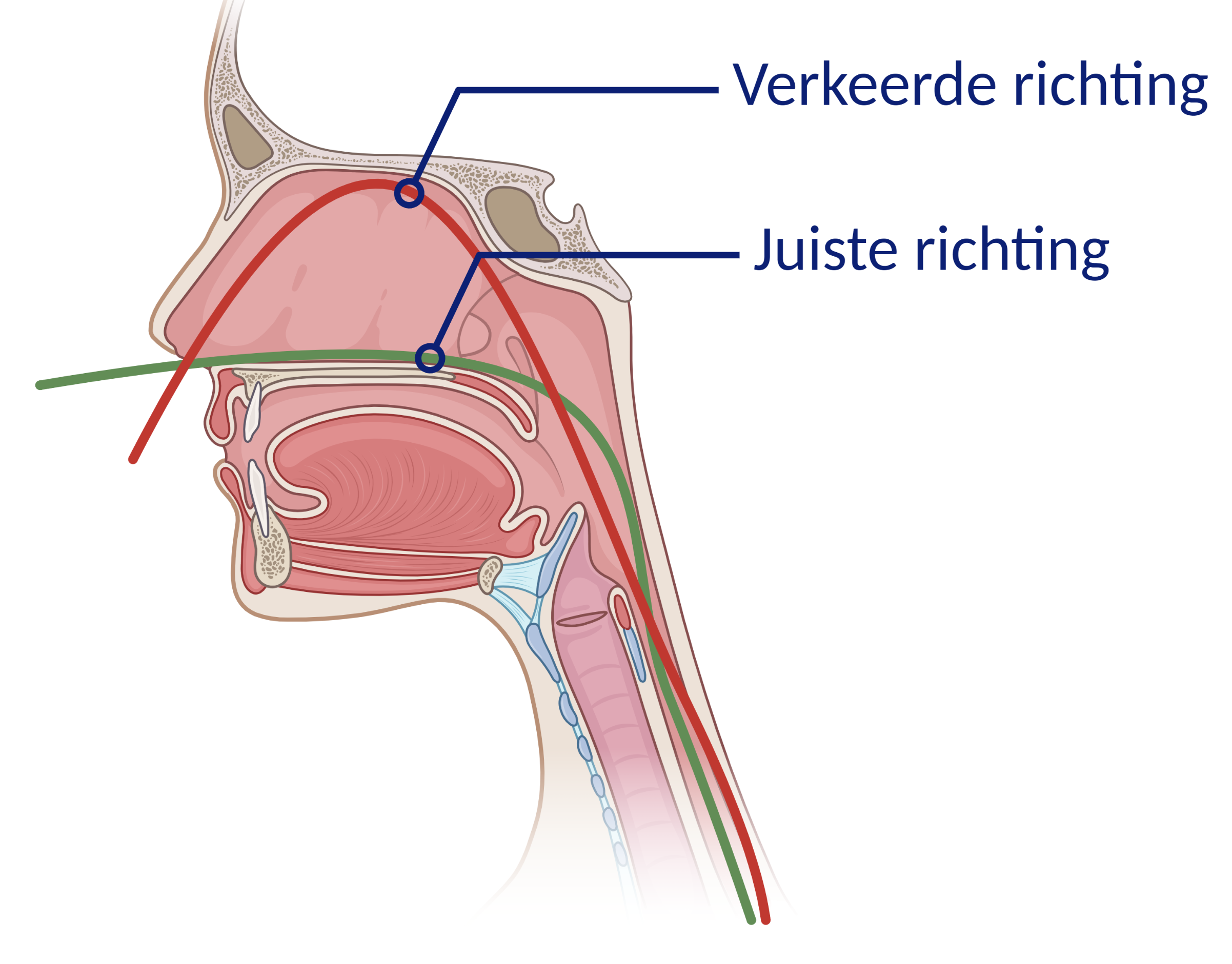 Inbrengen Van Een Maagsonde - Patiëntenfolder - Erasmus MC